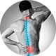 Điều trị bệnh đau lưng